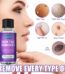 Achill Remover Serum 10ML Price in Bangladesh | resellKori