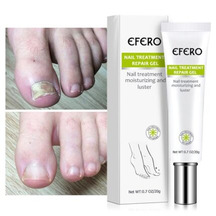 Efero Nail Repair Treatment Gel Fungus Cream-20gm Price in Bangladesh | resellKori